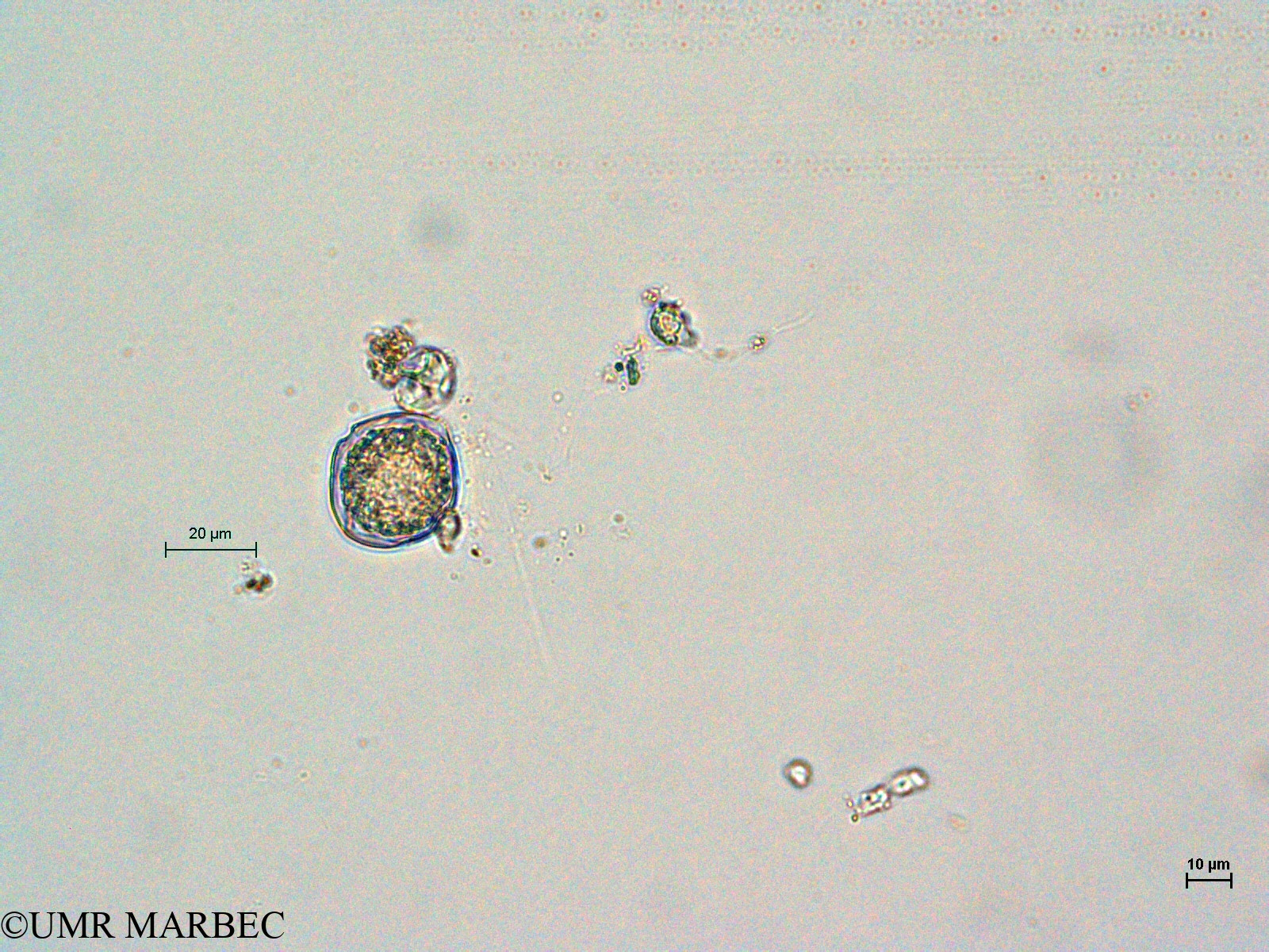 phyto/Thau_Lagoon/THAU_station1/GELAMED 2010/Pentapharsodinium dalei (old Protoperidinium americanum -3)(copy).jpg
